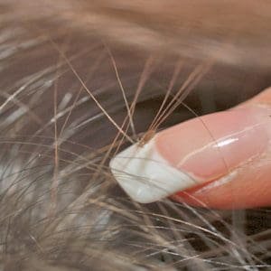 What Do Head Lice Look Like | Professional Lice Treatment at Lice Clinics  of America