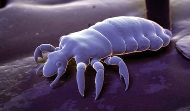 Macro view of a louse on someone's scalp