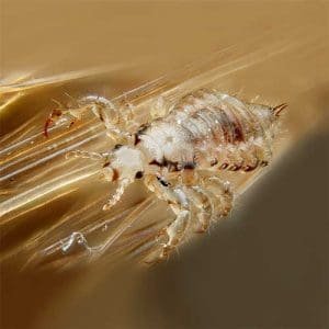 Magnified head lice on hair strands